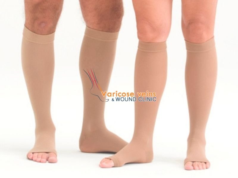 Compression Stockings: Your Complete Guide to Keeping Varicose